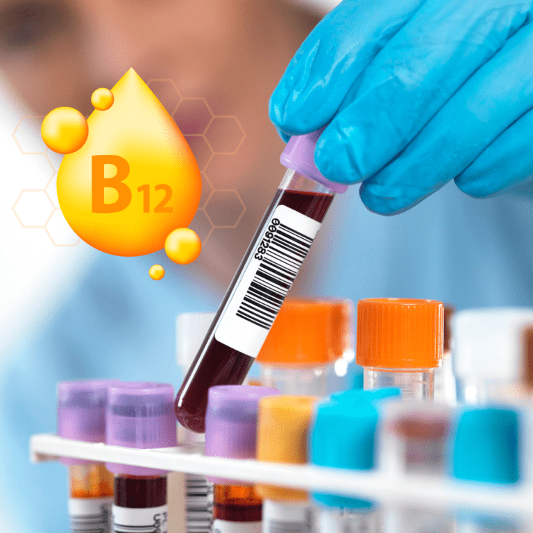 Vitamin B12 Test at Home in Dubai