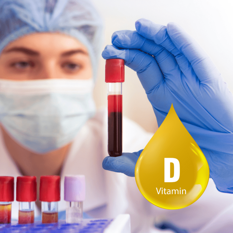 Vitamin D test at Home in Dubai