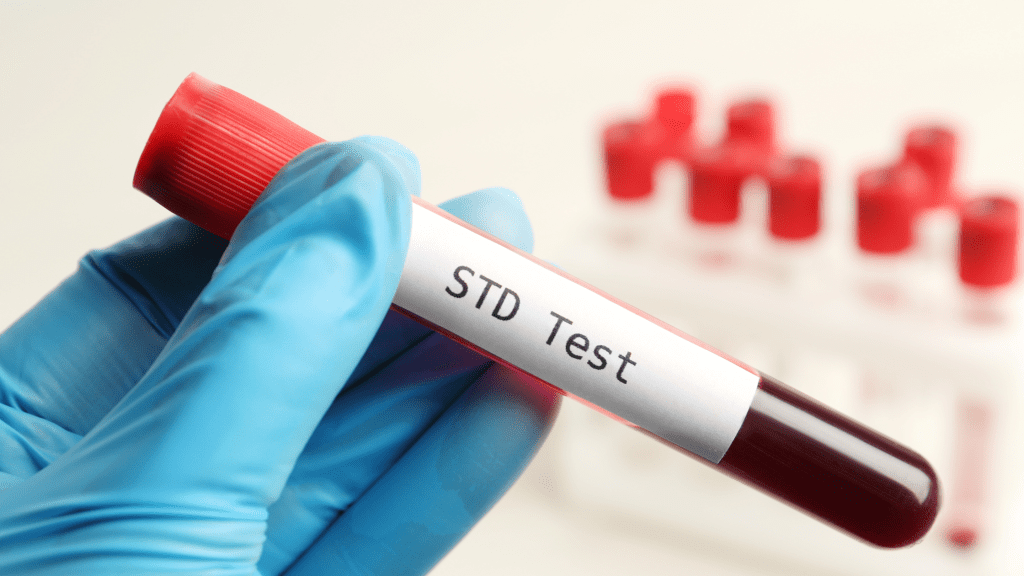 Private and confidential at home STD test in dubai