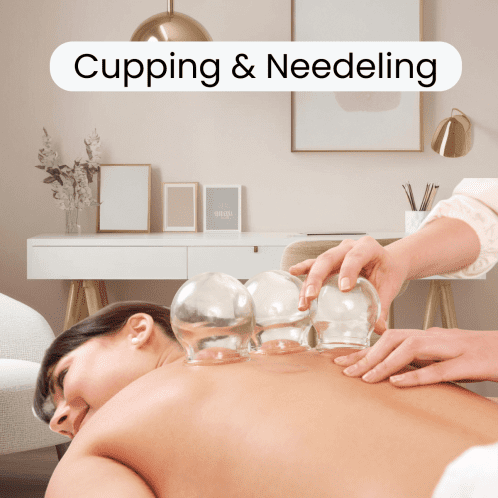 Cupping & Needling