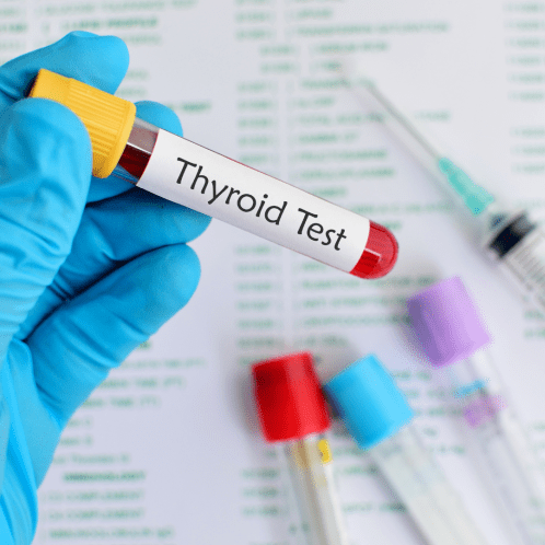 Thyroid test at Home in Dubai
