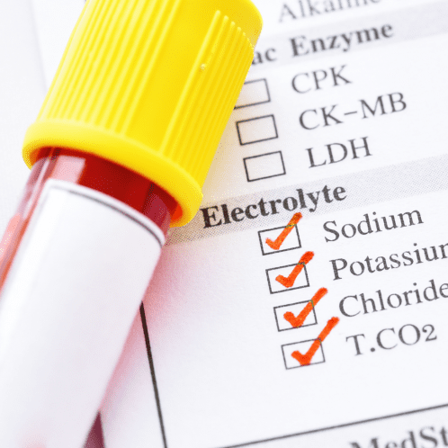 ELECTROLYTES PANEL TEST AT HOME IN DUBAI